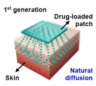 第一代透皮给药技术：通过药物的自然扩散.jpg