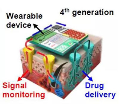 第四代透皮给药技术：在可穿戴设备的帮助下，用于患者定制治疗.jpg
