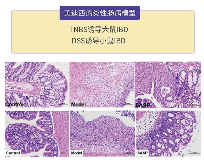 k8国际的炎性肠病模型.png